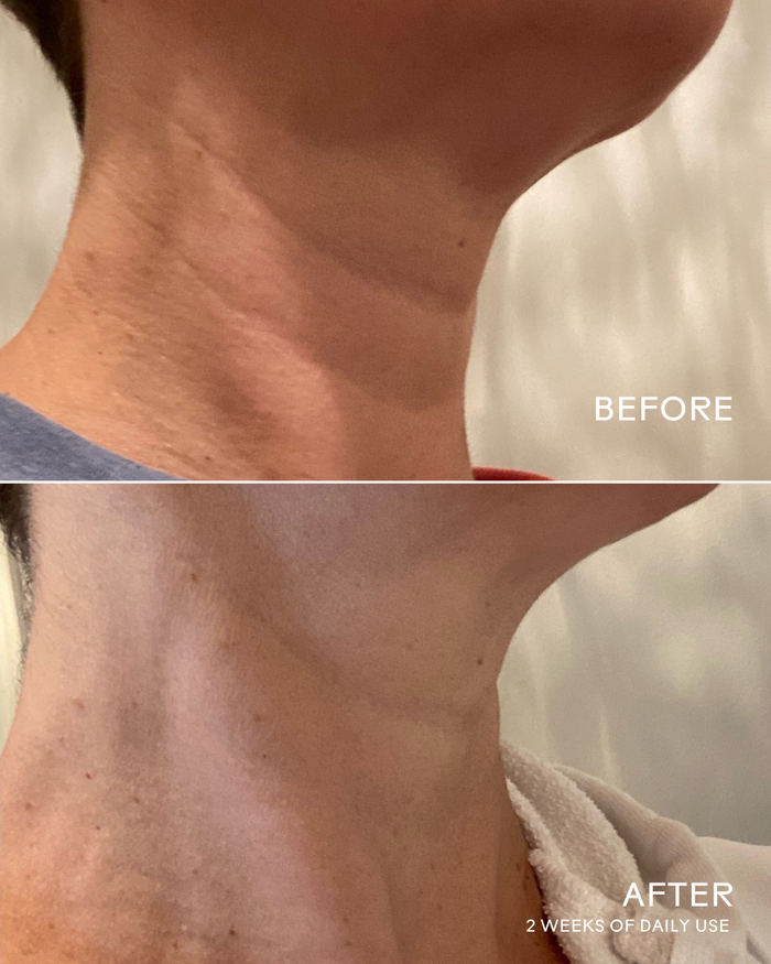Before and after close-up comparison of a neck showing smoother skin after 2 weeks of daily use of Firm Believer Goji Stem Cell + Pomegranate Smoothing Neck + Face Cream | Three Ships.