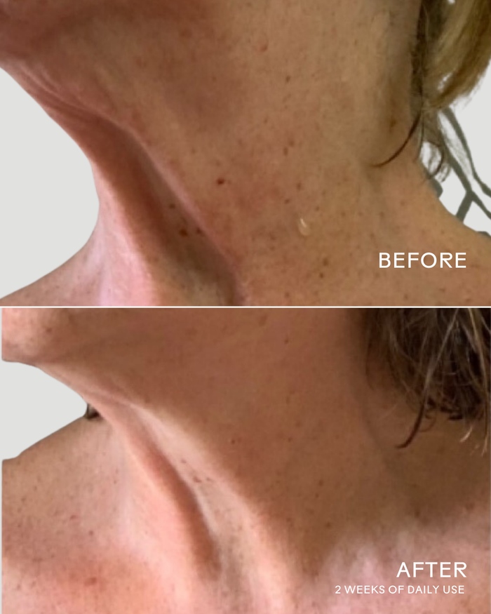 Close-up comparison of a neck and lower face skin before and after 2 weeks of daily use of Firm Believer Goji Stem Cell + Pomegranate Smoothing Neck + Face Cream | Three Ships, showing improved smoothness and texture.