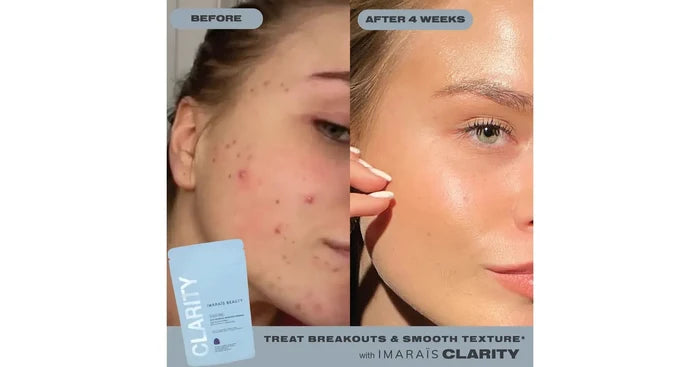 Imarais Anti-Blemish Skincare Gummies - CLARITY (30/pack)